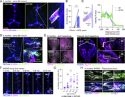 Progressive amyloidosis of bridging veins in 5XFAD mice. (A) Representative images of duras from 5-mo-old 5XFAD mice and littermate controls stained for the vascular marker PECAM-1, ACE point marker DPP4, and pan-Aβ antibody D54D2. Scale = 2 mm, inset = 200 μm. (B) Quantification of the area of Aβ within ACE points and the rest of the dura in 5XFAD mice. Two-tailed paired t test, N = 10. ***P < 0.001. (C) Schematic for the quantification of Aβ intensity, relative to ACE points. Line profiles of DPP4 and Aβ intensity, relative to the terminal of the ACE point (0 μm). N = 44 bridging veins from N = 7 5XFAD animals, mean ± SEM. (D) Representative image of a 5-mo-old 5XFAD mouse, stained for the vascular marker PECAM-1, ACE point marker DPP4, and pan-Aβ antibody D54D2, highlighting bridging vein and dural amyloidosis. Scale = 2 mm, insets = 200 μm. (E) Representative stereomicroscopy images of skull bases (with attached dura) stained with the ACE point marker DPP4 and pan-Aβ antibody D54D2. Representative light-sheet microscopy of a cleared skull base with the vascular marker PODXL, ACE point marker GLUT1, and pan-Aβ antibody D54D2. Scale = 2 mm, insets = 200 μm. (F) Representative images of amyloidosis of bridging veins along the superior sagittal sinus of 5XFAD mice up to 10 mo old. Duras are stained for the vascular marker PECAM-1, ACE point marker DPP4, and pan-Aβ antibody D54D2. Scale = 2 mm. (G) Quantification of Aβ staining intensity within the DPP4-positive area of ACE points between 1 and 10 mo in 5XFAD mice. Two-way ANOVA with Tukey’s post hoc test. Mean ± SEM. P values are given for the comparison between 1- and 2-mo-old 5XFAD and other time points. N = 1–22 mice per time point. ns, P > 0.05, nonsignificant; ***P < 0.001. (H) Representative images of dural amyloidosis around lymphatic vessels at the transverse sinus. Blood vasculature is stained with PECAM-1, ACE points with DPP4, lymphatic vessels and macrophages with LYVE-1, as well as the pan-Aβ antibody D54D2. Scale = 200 μm.
