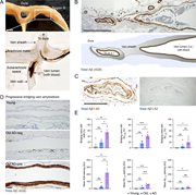 Amyloidosis of bridging veins in postmortem specimens from cognitively intact adults and cognitively impaired adults with AD pathology and dementia. (A) Top: Representative low-magnification image of a formalin-fixed paraffin-embedded dural sample, sectioned coronally through the superior sagittal sinus (SSS). Bottom: Representative image of a section through a bridging vein from the dura mater as it drains into the SSS. Scale = 2 mm. (B) Representative low-magnification image and schematic of anti–pan-Aβ (4G8) label around a bridging vein in an specimen from an old adult with AD pathology and dementia. Scale = 200 μm. c.s., cross section; l.s., longitudinal section; VL, vein lumen. (C) Representative images of anti-Aβ1-40 and anti-Aβ1-42 labeling around bridging veins from an old adult with AD pathology and dementia. Scale = 200 μm. (D) Representative images of anti–pan-Aβ (4G8) labeling in bridging veins from cognitively normal young and old adults without neurological disease and a cognitively impaired adult with AD pathology and dementia. Scale = 200 μm. (E) Quantification of the proportion (top row) and intensity (bottom row) of bridging veins stained with anti–pan-Aβ antibody (4G8), and antibodies against anti-Aβ1-40 and anti-Aβ1-42. N = 5. One-way ANOVA with Tukey’s post-hoc test, mean ± SEM. *P < 0.05; **P < 0.01; ***P < 0.001; ns, P > 0.05, nonsignificant.
