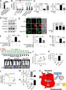 PTL suppresses brain tumor progression by blocking nicotine-induced M2 microglia polarization. (A) Human microglia cells (HMC3) with the Arg1 reporter plasmid were cultured in the presence or absence of compounds that were identified as the top three most effective inhibitors for Arg1 during our initial screening (see Materials and methods). After 48 h of incubation, luciferase reporter activity was measured (n = 4/group). (B) Expression of surface markers of M1/M2 microglia was examined by qRT-PCR after microglial cells were treated with or without nicotine plus PTL (n = 4/group). (C) The same set of samples in B was evaluated for quantification of Iba1+/CD11b+ (M1) cells and Iba1+/CD206+ (M2) cells by FACS (n = 4/group). (D) The same set of samples in C was examined for quantification of the protein expression of JAK2 and STAT3 by Western blot. (E) Human microglial (HMC3) cells (green) with or without nicotine treatment (1 µM) in the presence or absence of PTL (1 µM) were incubated with PKH26-labeled H2030BrM cells (red) for 24 h and photographed (left panels), followed by measurement of the microglial phagocytic activity (right panel; n = 4/group). Scale bar, 10 µm. (F) CM was prepared from human microglia (HMC3) treated with or without nicotine and PTL. The CM was added to the culture of H2030BrM, and cells were incubated for 48 h followed by evaluation of CSC population by FACS. Non-nicotine, nicotine, or Nico+PTL CM: microglia were treated with PBS, nicotine, or nicotine plus PTL for 24 h. They were then washed twice with PBS and incubated in the fresh DMEM/F12 medium supplemented with 2% FBS for a further 24 h (n = 4/group). (G) For the same set of samples as F, colony-forming ability was also measured (n = 4/group). (H) Human microglia were treated with or without nicotine (1 µM) in the presence or absence of PTL for 24 h, followed by assessment of the expression of CCL20 by qRT-PCR (n = 4/group). (I) The mouse lung cancer cells, LL/2, were intracardially injected into wild-type BALB/c mice. After 3 d of intracranial transplantation of LL/2 cells, mice received nicotine (1 mg/kg) plus PTL (1 mg/kg) by an intraperitoneal injection every 3 d for 40 d. Upper panel: BLI images of representative mice from each experimental group at day 40. Lower panel: total photon flux of ex vivo brain metastatic lesions was measured by BLI at the endpoint (day 40; n = 9/group). (J) Quantitative data of BLI in the brain regions are shown (n = 9/group). (K) Ex vivo signals in the whole brains at the end point were quantified. (L) The Kaplan–Meier analysis of brain metastasis–free survival was performed (n = 9/group). (M and N) Metastatic brain tumors in I were isolated from the brain and were examined by FACS for M2 (M) and M1 (N) microglial polarization (n = 9/group). (O) A proposed model illustrating a nicotine-induced brain metastasis (n = 9/group). The data are presented as the mean ± SD. *, P < 0.05; **, P < 0.01; and ***, P < 0.001.