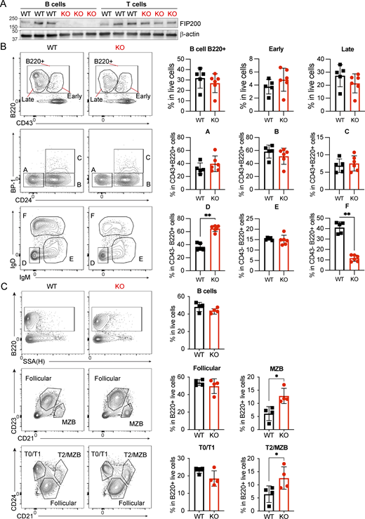 B cell development in B-Fip200−/−mice, related to Fig. 1. (A) Naïve B cells and CD4+ T cells were isolated from the spleens of WT or B-Fip200−/− mice (n = 3), and FIP200 expression was detected by western blot. (B and C) Flow cytometry analysis of BM (B) or spleen (C) from WT and Fip200-KO-B mice. (B) BM samples were stained with antibodies against CD43, CD24, BP-1, IgM, IgD, and B220, and populations were identified following the Hardy classification system: B cells (B220+), early progenitors (B220+CD43+), late progenitors (B220+CD43−), fraction A (CD43+CD24−BP-1−), fraction B (CD43+CD24+BP-1−), fraction C (CD43+ CD24+ BP-1+), fraction D (CD43−IgM−IgD−), fraction E (CD43−IgM+IgD−), fraction F (CD43−IgM+IgD+). Left to right: **P = 0.0043, **P = 0.0043. (C) Spleen samples were stained with antibodies against CD21, CD23, CD24, and B220, and transitional or mature B cell populations were identified—B cells (B220+), T0-T1 cells (B220+CD21loCD24hi), T2-MZB cells (B220+CD21hiCD24hi), MZB cells (B220+CD21hiCD23lo), follicular B cells (B220+CD21hiCD23+). Two replicates were performed with three to five animals in each group; one representative experiment is shown. Significant P values were determined by an unpaired t test. Top to bottom: *P = 0.0286, *P = 0.0286. Source data are available for this figure: SourceData FS1.