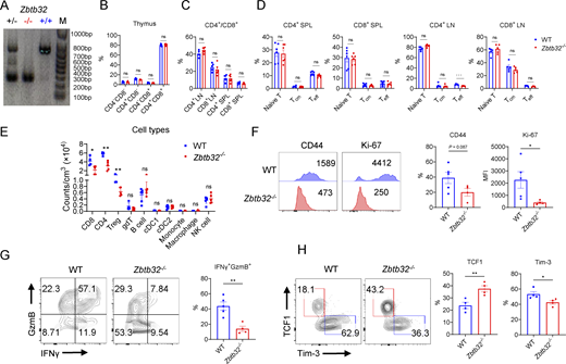Zbtb32 ablation worsens CD8+T cell anti-tumor capability. (A) Characterization of Zbtb32−/− mice. (B) Quantification of CD4+/CD8+ cell ratio in thymus in WT and Zbtb32−/− mice (n = 6 for each group). (C) Quantification of CD4+/CD8+ T cell ratio in SPL and LN in WT and Zbtb32−/− mice (n = 6 for each group). (D) Quantification of different subsets of CD4+/CD8+ cells in SPL and LN in WT and Zbtb32−/− mice (n = 6 for each group). (E) Quantification of cell counts of different immune cell types in WT and Zbtb32−/− CD8+ TILs in B16-OVA TME (n = 5 for each group). (F) MFI and quantification of CD44 and Ki-67 in WT and Zbtb32−/− CD8+ TILs in B16-OVA TME (n = 5 for each group). (G) Representative plots and quantification of IFNγ, GzmB, and CD8+/CD4+ ratio in WT and Zbtb32−/− CD8+ TILs in B16-OVA TME. (H) Representative FACS plots (left panel) and quantification (right panel) of TCF1 and Tim-3 in WT and Zbtb32−/− CD8+ TILs in B16-OVA TME (n = 5 for each group). Data are all shown as means ± SEM; ns, not significant; *P < 0.05 and **P < 0.01 by unpaired two-tailed Student’s t test. Data shown in all graphs are a representative of two independent experiments. Source data are available for this figure: SourceData FS2. Refer to the image caption for details.