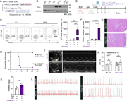 Immune checkpoint inhibition drives myocarditis in a novel mouse model. (A) Schematic diagram illustrating the DTG tetracycline–repressor system, driven by a myosin heavy chain, α isoform (MHC-α) promoter, for inducible overexpression of OVA in the heart. (B) Representative western blot for OVA from hearts of WT, tetracycline-regulated transactivator (tTA), OVA TG, OVA DTG, and OVA DTG + doxycycline (DOX) mice. β-Tubulin included for loading control. (C) Experimental regimen of early DOX administration to inhibit OVA expression during embryonic and postnatal development in DTG animals (DOX was removed at 5 wk of age). Transfer of 105 purified naive OTI T cells (injected retro-orbitally) was followed by the administration of αCTLA-4 and αPD-1 mouse monoclonal antibodies (dual ICI, 200 μg IP each). (D) Representative flow cytometry contour plots of CD45.1 congenically marked TCR Vα2+ OTI cells in the heart at day 9 following the adoptive transfer of OTI cells for myocarditis induction (pre-gated on live CD45.2+CD90.2+CD8+ cells). (E) Quantification of OTI expansion indicated by cells per mg of cardiac tissue. (F) Quantification of cardiac-infiltrating immune cells measured via flow cytometric analysis of CD45.2+ cells (n = 3). (G) Representative histological images of hearts stained with H&E from DTG mice receiving adoptive transfer (no ICI) and DTG mice receiving αCTLA-4 and αPD-1 (ICI) following OTI transfer (+dual ICI). Scale bar, 200 μm. (H) Kaplan–Meier survival curve following transfer of 106 OTI cells, with or without dual ICI administration (n = 8–9). (I) Representative echocardiograms performed at day 7 after adoptive transfer. (J) Echocardiographic analysis of fractional shortening (%FS) (n = 8–9). “D-1” indicates baseline %FS prior to adoptive transfer. (K) Heart weight-to-body weight (HW/BW) ratio (n = 6–8). (L) Representative electrocardiograms recorded at day 7 after transfer. All data points in graphs represent biological replicates. Statistical analysis performed via one-way ANOVA (E and F) and Student’s t test (H, J, and K). P value determined using Mantel–Cox log-rank (H). All data shown are mean ± SEM (E, F, J, and K). Data are representative of two to three independent experiments. **P < 0.01, ***P < 0.001; ns, not significant. Source data are available for this figure: SourceData F1.