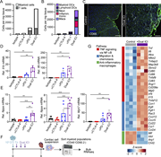 Cardiac-specific CD8 T cells drive innate inflammation and myocardial damage. (A) Quantification of cardiac-infiltrating myeloid cells (CD45.2+CD11b+ and CD45.2+CD11c+) and total T cells (endogenous and OTI T cells, CD45.2+CD90.2+) determined by flow cytometry analysis of the total heart on day 9 after adoptive transfer. (B) Delineation of myeloid subsets including myeloid DCs (CD11b+CD11c+), lymphoid DCs (CD11b−CD11c+), neutrophils (Neut) (CD11b+CD11c−Ly6chiLy6Ghi), inflammatory monocytes (Inflamm. mono) (CD11b+CD11c−Ly6chiLy6Glo), and macrophages (Macs) (CD11b+F4/80+). Statistics included in Fig. S4 B. (C) Representative immunohistochemistry for myeloid cells (CD68-white) and cell outlines with wheat germ agglutinin (WGA) (green) with DAPI-stained nuclei (blue) from ICI and control hearts at day 9 after OTI T cell transfer. Scale bar, 100 μm. (D) qRT-PCR analysis of Il1b and Il6 mRNA expression relative to Gapdh expression from bulk cardiac tissue (n = 3–6). (D and E) qRT-PCR analysis of Nppa, Nppb, and Myh7 mRNA expression from bulk cardiac tissue (n = 3–6). Statistical analysis performed via one-way ANOVA (D and E). Depicted as mean ± SEM. Data are representative of two independent experiments (A–E). (F) Schematic of experimental outline for bulk RNA-seq analysis of FACS-purified immune cells (CD45.2+CD90.2−) isolated from hearts of ICI-treated or untreated mice on day 9 after adoptive transfer. (G) Heatmap of inflammatory genes in sorted cardiac-infiltrating myeloid cells from mice treated with ICI following OT-I–adoptive transfer, compared with isotype antibody–treated control mice. The heatmap displays row-wise Z-scores of DESeq2-normalized RNA-seq counts. Each column represents a biological replicate sample grouped by treatment, while genes are grouped by pathways. Data are representative of a single experiment with three biological replicates per condition (G). *P < 0.05, **P < 0.01, and ***P < 0.001; ns, not significant.