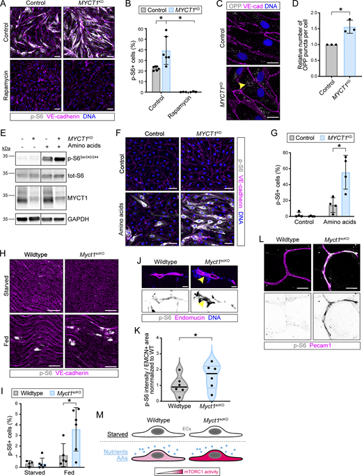 The image shows multiple panels of experimental data on M Y C T 1 and m T O R C 1 signaling in endothelial cells.