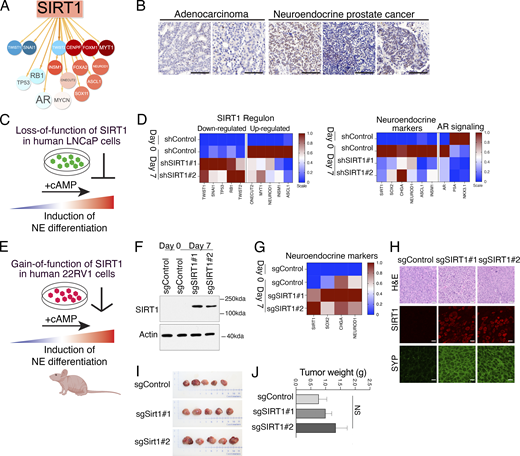 A multi-panel image exploring the role of SIRT1 in neuroendocrine prostate cancer.