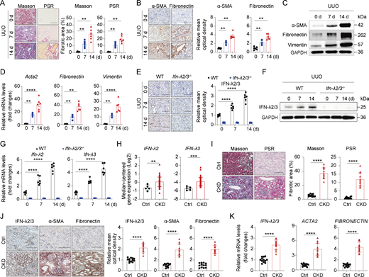 Multiple graphs and images depict the role of IFN-λ in renal fibrosis, showing various analyses of fibrotic markers in mice and human kidneys.