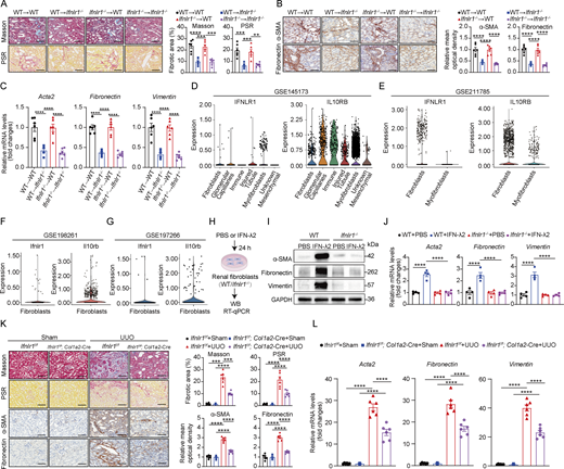 A multi-panel image depicts the role of IFN-λ in renal fibrosis using various experimental approaches.