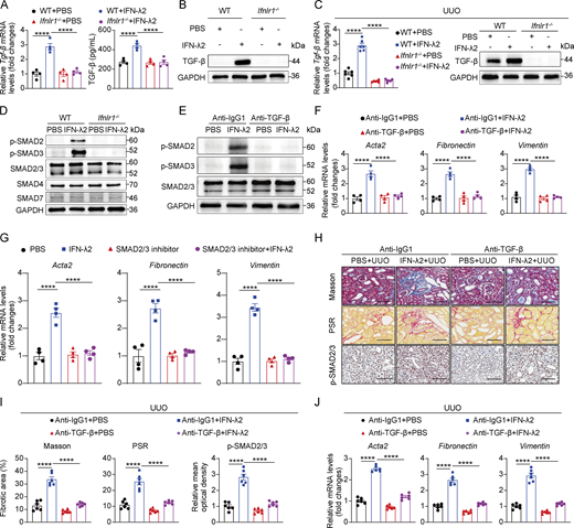 A multi-panel image depicts the effects of IFN-λ2 on TGF-β expression and signaling in renal fibroblasts and the impact on renal fibrosis.
