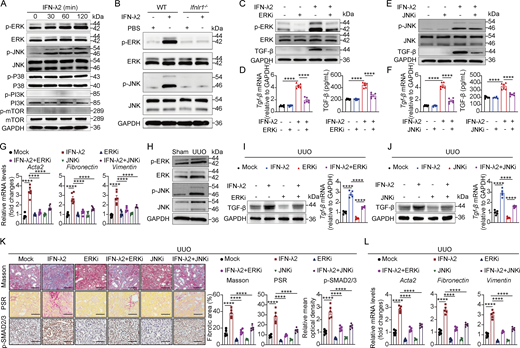 A multi-panel image depicts the effects of IFN-λ2 on TGF-β synthesis in renal fibroblasts.