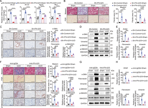 A multi-panel image depicts renal fibrosis in mice.