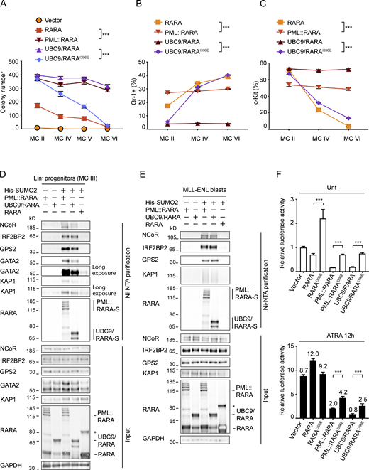 A multi-panel image depicts the effects of UBC9/RARA fusion on progenitor cells.