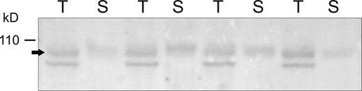 Microsomal and surface fractions of βENaC from rat kidney. Kidneys from four individual rats were perfused in situ with a filtered, impermeant biotinylating reagent. Kidneys were homogenized, microsomes were prepared by centrifugation, and surface fractions were isolated using Neutravidin beads. Lanes of the Western blot were loaded with either 30 μg of total microsomes (T) or Neutravidin eluate obtained from 530 μg of the microsomes (S). The ratio of the signals T/S for individual animals was 0.84 ± 0.21, indicating that 4.8 ± 1.2% of the proteins in the microsomes were recovered in the eluate. Source data are available for this figure: SourceData F5.
