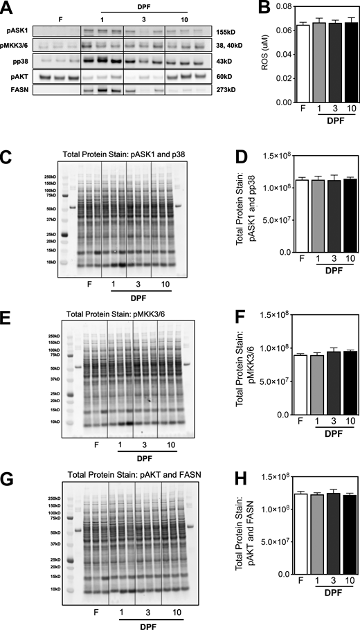 Western blots used for quantitative analysis and normalization. (A) Western blot used for quantitative analysis of pASK1, pMKK3/6, pp38, pAKT, and FASN. (B) ROS level, quantitative analysis. (C and D) Western blot total protein stain used for normalization of pASK1 and pp38. (E and F) Western blot total protein stain used for normalization of pMKK3/6. (G and H) Western blot total protein stain used for normalization of pAKT and FASN. Source data are available for this figure: SourceData FS4. Refer to the image caption for details.