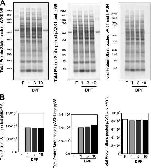Western blots used for representative blots.(A and B) Western blot total protein stain of representative blots showed in Fig. 5 A. Source data are available for this figure: SourceData FS5. Refer to the image caption for details.