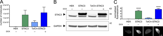 Both the constitutive and the inducible STAC3-HEK cell lines robustly express STAC3. (A) STAC3 mRNA transcription levels in the host (HEK), the constitutive (STAC3), and the inducible (TetOn-STAC3) cell line, before and after DOX treatment, assessed by TaqMan quantitative PCR. Mean values of three replicates. (B) Western blot analysis with anti-STAC3 antibody indicated that STAC3 is substantially expressed by the constitutive and inducible cell lines (treated with DOX), while it is absent from the host cell line (HEK). Without DOX, the inducible cell line shows very low basal expression. An unspecific band present in all samples migrates slightly faster than STAC3. One representative experiment of three is shown. (C) Quantification of STAC3 staining intensity in the host (HEK), the constitutive (STAC3), and the inducible cell line (TetOn-STAC3), before and after DOX treatment reveals strong STAC3 expression in both STAC3 and TetOn-STAC3 cell lines. Scale bar, 2 µm. ANOVA, F(3,169) = 67.72; P < 0.0001; Tukey post hoc analysis; ****, P < 0.0001. Source data are available for this figure: SourceData F1. Refer to the image caption for details.
