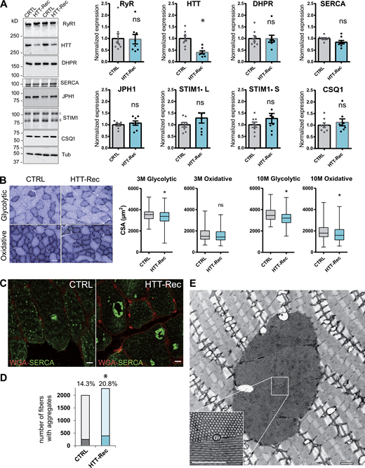 Morphological characterization of the muscles of HTT-Rec mice. (A) Western blot analysis of RyR1, HTT, DHPR-α1S, JPH1, STIM1, SERCA, and CSQ1 in TA muscle homogenates from CTRL and HTT-Rec 10 mo old mice. Tubulin is the loading control. Eight mice per group, each dot represents a mouse, the value for each mouse is the mean of three Western blots. Statistical analysis: unpaired t test, HTT-Rec versus CTRL, RyR1 P = 0.9208, HTT P = 0.0006, DHPR P = 0.9681, JPH1 P = 0.5164, STIM1L P = 0.2478, STIM1S P = 0.2856, SERCA P = 0.0547, CSQ1 P = 0.5036. (B) The CSA was measured in glycolytic and oxidative fibers from CTRL and HTT-Rec TA muscle stained with NADH at 3 mo of age. Representative images of TA sections in regions enriched in glycolytic fibers or oxidative fibers in CRTL or HTT-Rec at 3 mo, are presented. Scale bar, 50 µm. Quantification has been performed on n = 375 fibers from three CTRL mice and n = 495 fibers from three HTT-Rec mice. Student’s t test, P = 0.0038 for glycolytic fibers and P= 0.1667 for oxidative fibers. CSA was measured in glycolytic and oxidative fibers from CTRL and HTT-Rec TA muscle stained with NADH at 10 mo of age, on n = 399 fibers from three CTRL mice and n = 450 fibers from three HTT-Rec mice. Student’s t test, P < 0.0001 for glycolytic fibers and oxidative fibers. (C) Representative confocal images of tubular aggregates in TA of 10 mo old CTRL and HTT-Rec mice using WGA (red) and SERCA (green). Scale bar, 10 µm. (D) The number of fibers containing SERCA aggregates was determined out of the total number of fibers (WGA staining) on n = 3–4 mice per genotype. Of note: the labeling of the aggregates with the SERCA antibody is so strong that the labeling of SERCA in the whole SR is not visible. The χ2 test was used to determine whether there was a significant difference between the frequencies of fibers with aggregates: CTRL, 251 out of 1,749 (14.3%); HTT-Rec, 392 out of 1,878 (20.8%); χ2 = 26.414, P < 0.0001. (E) Representative EM picture of longitudinal TA section of HTT-Rec mouse. Scale bar, 1 µm. Source data are available for this figure: SourceData F6. Refer to the image caption for details.