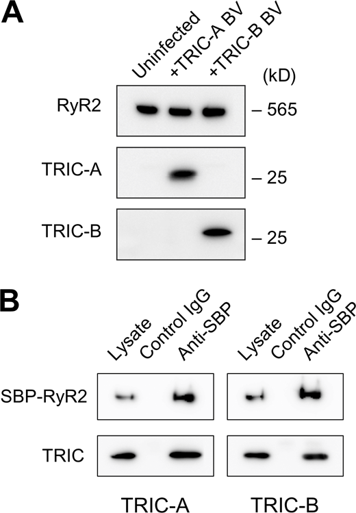 Expression of TRIC channels and their interaction with RyR2. (A) Western blots of the microsomal membrane vesicles isolated from RyR2-expressing HEK293 cells that were either uninfected (left), infected with TRIC-A baculovirus (BV; center), or TRIC-B BV (right). (B) Interaction of TRIC channels with RyR2. SBP-tagged RyR2-expressing HEK293 cells were infected with TRIC-A (left) or TRIC-B (right) BV. The cell lysate was immunoprecipitated with control IgG or anti-SBP antibody. Lysate and the immunoprecipitated product were analyzed by Western blotting. Note that both TRIC-A and TRIC-B were coimmunoprecipitated with RyR2. Source data are available for this figure: SourceData FS1. Refer to the image caption for details.