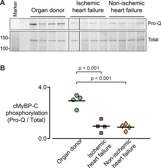 Decreased cMyBP-C phosphorylation with heart failure. (A) cMyBP-C was extracted from four heart samples from each group (Tables 1 and 2) and phosphorylation levels were determined from Pro-Q diamond phospho-stain versus total protein stain. (B) Densitometry analysis for each lane in A was used to calculate the level of cMyBP-C phosphorylation. A single measurement was made for each of the four hearts from each group, indicated in Tables 1 and 2. Molecular weights (kD) are listed to the left of A. Source data are available for this figure: SourceData F7.