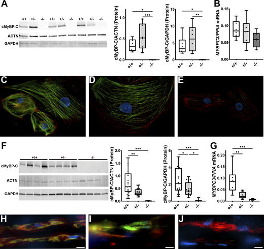 Expression of cMyBP-C in hiPSC-CMs in monolayer culture and hiPSC-ECT. (A and F) Western blot analysis of cMyBP-C, α-actinin (ACTN), and GAPDH in day 30 hiPSC-CM (A) and hiPSC-ECT (F). The center and right-hand panels in A and F show cMyBP-C protein levels normalized to ACTN and GAPDH, respectively, cMyBP-C+/+, cMyBP-C+/−, and cMyBP-C−/− in day 30 hiPSC-CM (A) and hiPSC-ECT (F). (B–E, and G–J) Box and whisker plot of qRT-PCR assessment of MYBPC3 transcript levels in cMyBP-C+/+, cMyBP-C+/−, and cMyBP-C−/− day 30 hiPSC-CM (B) and hiPSC-ECT (G). Immunocytochemistry preformed on day 30 hiPSC-CM (C–E) and immunohistochemistry performed on hiPSC-ECT (H–J) showing cMyBP-C (green), α-actinin (red), and DAPI (blue) in cMyBP-C+/+ (C and H), cMyBP-C+/− (D and I), and cMyBP-C−/− (E and J). n ≥ 6 biological replicates; *P < 0.05; **P < 0.01; ***P < 0.001 as calculated by one-way ANOVA with Tukey’s multiple comparisons test; see Table S3 for specific P values.