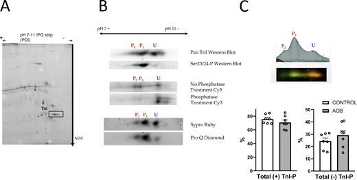 2-D–DIGE analysis of TnI phosphorylation. Cardiac samples of Sham and AOB were analyzed by 2-D–DIGE. The first dimension was performed by electro focusing on IPTG strips pH range 7–11. The next dimension was performed on SDS-PAGE gels for molecular weight separation. A shows a representative 2-D–DIGE gel (pH 7–11) wherein Sham and AOB samples were tagged with Cy3 and Cy5 dyes. The TnI spots are indicated by the square box in the bottom right area of the 2-D gel. B illustrates strategies employed to identify the TnI gel spots of this sample. Top: Pan-total TnI antibody and Ser23/24 phospho-specific antibody Western blots. Middle: 2-D–DIGE analysis of untreated pooled samples stained with Cy5 and PP1, and PP2A-treated pooled samples stained with Cy3. Bottom: Sypro Ruby total protein and ProQ Diamond gel stains that identify phosphorylated proteins. From these results, we were able to identify the TnI gel spots as unphosphorylated (U), single (P1), and double phosphorylated (P2) as indicated. C shows an example of the 2-D–DIGE results where Sham and AOB differentially labeled samples are run together and analyzed by the GE Decyder 2-D–DIGE analysis package. The top panel illustrates the differential analysis based on simultaneous scanning of the Cy3 and Cy5 channels. The bottom bar graphs show the average (n = 7 for Sham and n = 7 AOB) level of unphosphorylated (U spot) and total phosphorylated (P1 + P2) cardiac TnI. On average, the phosphorylation level of TnI was slightly, albeit not significantly, decreased in the AOB group. Sham control, open bars; AOB, closed bars. Sham control vs. AOB: (+) TnI-P P = 0.299; (−) TnI-P P = 0.668). Source data are available for this figure: SourceData F3