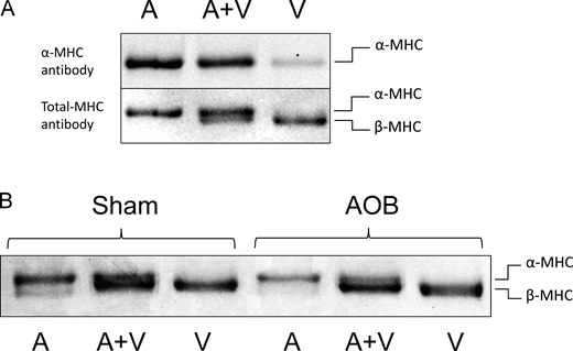Cardiac MHC isoform composition. Cardiac MHC isoform composition was assessed by SDS-PAGE electrophoresis (Rundell et al., 2005). (A) Identification of protein bands by Western blot antibody staining. The three lanes shown were loaded with an atrial extract (left lane A; contains mostly α-MHC), a ventricular extract (right lane V; contains mostly β-MHC), and an atrial + ventricular mixture (middle lane A + V). An α-MHC specific antibody (top) only detected bands in the left A and middle A + V lane, while a pan-MHC (total MHC) antibody detected bands in all lanes; here, separation between the two MHC isoforms is evident. (B) Sypro Ruby total protein stain was used to measure MHC composition. Representative lanes of atrial (A), ventricular (V), and A + V are shown for a Sham and AOB cardiac sample. In all samples studied, α-MHC was below the detection limit (n = 3 Sham hearts and n = 3 AOB hearts). Source data are available for this figure: SourceData F5