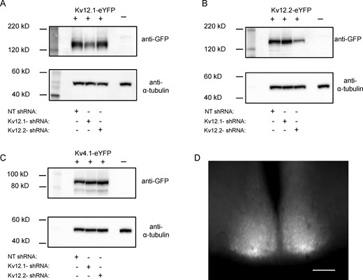 Validation of the Kv12.1-targeted and Kv12.2-targeted shRNAs. To examine the specificity of the selected Kv12.1-targeted and Kv12.2-targeted shRNAs, each was expressed in tsA-201 cells with a cDNA construct encoding Kv12.1-eYFP, Kv12.2-eYFP, or Kv4.1-eYFP; parallel experiments were completed with the NT shRNA. Approximately 24 h following transfections, cell lysates were prepared, fractionated by SDS-PAGE, transferred to PVDF membranes, and probed with an anti-GFP antibody. All blots were also subsequently probed with an anti-α-tubulin antibody to verify equal protein loading. (A) Co-expression with the Kv12.1-targeted shRNA markedly reduced Kv12.1-eYFP protein expression, whereas the Kv12.2-targeted shRNA and the NT shRNA were without effects on Kv12.1-eYFP. (B) Similarly, co-expression with the Kv12.2-targeted shRNA, but not the Kv12.1-targeted or the NT shRNA, reduced Kv12.2-eYFP protein expression. (C) In contrast, neither the Kv12.1-targeted nor the Kv12.2-targeted shRNA measurably affected expression of Kv4.1-eYFP. The complete blots from which the “cut outs” shown in A–C were derived are provided in the source data. (D) eGFP-expressing neurons were readily identified in acute SCN slices prepared 2 wk following bilateral injections of the Kv12.1-targeted (or the Kv12.2-targeted) shRNA-expressing AAV8 into the SCN; scale bar = 250 μm. Source data are available for this figure: SourceData F2. Refer to the image caption for details.