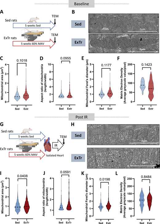 Effect of ExTr on mitochondrial shape in basal condition and after ex vivo IR. (A) Schematic illustration of the experimental protocol. Transmission electron microscopy was performed in the hearts of sedentary (Sed, n = 3) and 5-wk-exercised (ExTr, n = 3) rats. (B–F) Representative transmission electron microscopy images of cardiac mitochondria from Sed and ExTr hearts (Baseline). Quantification of the mitochondrial area (C), aspect ratio (D), Feret’s diameter (E), and matrix electron density (F) of hearts from Sed or ExTr rats. (G) Schematic illustration of the experimental protocol. Transmission electron microscopy was performed in the hearts of sedentary (Sed, n = 3) and 5-wk-exercised (ExTr, n = 3) rats after an ex vivo IR. (H–L) Representative transmission electron microscopy images of cardiac mitochondria from Sed and ExTr hearts after IR (Post-IR). Quantification of the mitochondrial area (I), aspect ratio (J), Feret’s diameter (K), and matrix electron density (L) of hearts from Sed or ExTr rats that underwent IR. The mitochondrial shape was measured in ∼600–750 mitochondria from three independent hearts in each condition. Sed versus ExTr P-value obtained with nested t test. Data are median and interquartile range. Source data are available for this figure: SourceData F3.
