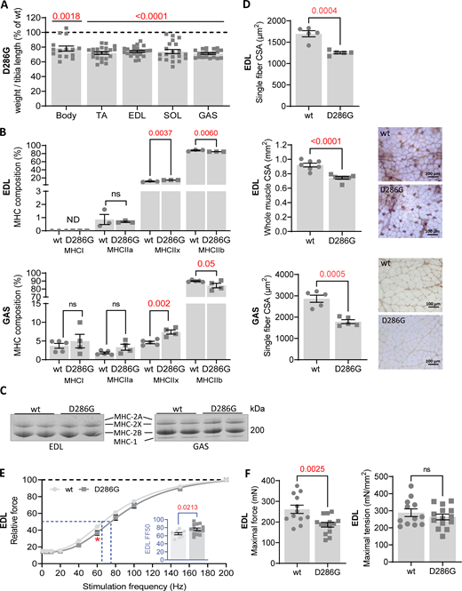 Characterization of Acta1(D286G) mouse model. (A) Body weight and wet muscle mass normalized over tibia length relative to the percentage of wild type values. (B) Top panel: MHC isoform composition of EDL muscle. Bottom panel: MHC isoform composition of GAS muscle. (C) Representative images of EDL and GAS MHC composition by SDS-PAGE gel. (D) Top panel: Whole EDL muscle CSA. Middle panel: CSA of EDL single fast fibers (2X and 2B). Right panels show immunostained representative cryosections (negative fibers are type 2X and 2B fibers). Bottom panel: GAS single 2X and 2B fast fibers CSA. Right panels show immunostained representative cryosections (negative fibers are type 2X and 2B fibers). Bottom panel: GAS single fiber CSA. (E) EDL force-frequency stimulation relation (inset shows FF50). (F) Left panel and right panel. EDL maximal force and maximal tension at 200 Hz stimulation frequency in wild type and Acta(D286G) mice. All data are presented as mean ± SEM. Statistical significance symbology: * ≤ 0.05, ** ≤ 0.01, *** ≤ 0.001. Source data are available for this figure: SourceData F1. Refer to the image caption for details.