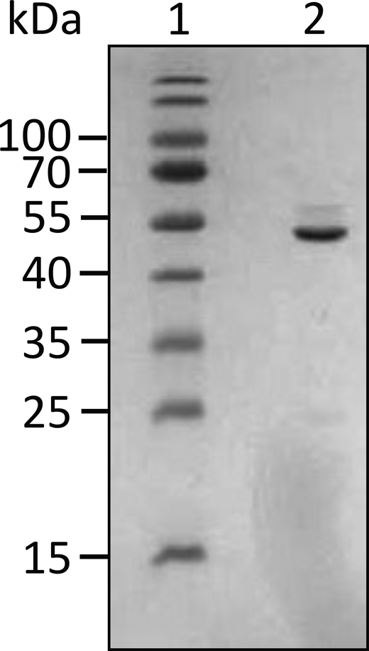 12% SDS-PAGE gel for UN2A-FRET. The UN2A region was PCR amplified as described in Tiffany et al. (2017). The resulting PCR product was digested using NdeI and XhoI and ligated into the CFP-YFP containing vector described by Ohashi et al. (2007). Sequence for UN2A-FRET:HHHHHHMVSKGEELFTGVVPILVELDGDVNGHKFSVSGEGEGDATYGKLTLKLLCTTGKLPVPWPTLVTTLGYGVQCFARYPDHMKQHDFFKSAMPEGYVQERTIFFKDDGNYKTRAEVKFEGDTLVNRIELKGIDFKEDGNILGHKLEYNYNSHNVYITADKQKNGIKANFKIRHNIEDGGVQLADHYQQNTPIGDGPVLLPDNHYLSYQSALFK DPNEKRDHMVLLEFLTAAGITEGMNELYK DERKKQEKIEGDLRAMLKKTPALKKGSGEEEEIDIMELLKNVDPKEYEKYARMYGITDFRGLLQAFELLKQSQEEETHRLEIEELEKSERDEKEFEELVAFIQQRLTQTEPVTLIKDMVSKGEELFGGIVPILVELEGDVNGHKFSVSGEGEGDATYGKLTLKFICTTGKLPVPWPTLVTTLTWGVQCFSRYPDHMKQHDFFKSVMPEGYVQERTIFFKDDGNYKTRAEVKFEGDTLVNRIELKGIDFKEDGNILGHKLEYNYISHNVYITADKQKNGIKANFKARHNITDGSVQLADHYQQNTPIGDGPVILPDNHYLSTQSALSKDPNEKRDHMVLLEFVTAAGITHGMDELYK. Source data are available for this figure: SourceData FS3. Refer to the image caption for details.