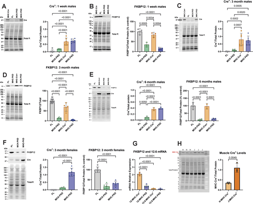 Cardiac Cre-recombinase and FKBP12 levels. (A) Cre+ levels in hearts from 1-wk-old male mice (n = 6 for each genotype). (B) FKBP12 levels in hearts from 1-wk-old male mice (n = 3). (C) Cre+ levels in hearts from 3-mo-old male mice (n = 6 for each genotype). (D) FKBP12 levels in hearts from 3-mo-old male mice (n = 14, 7, 4, and 14 for FL, MCK-FKD, MHC-Cre+, and MHC-FKD, respectively). (E) Cre+ levels and FKBP12 levels in hearts from 6-mo-old-male mice. (n = 4 for FL, MCK-FKD, and MHC-FKD, n = 2 for MHC-Cre+ only). (F) Cre+ levels and FKBP12 levels in hearts from 3-mo-old female mice (n = 6 for FL, MCK-FKD, and MHC-FKD. (G) Relative mRNA levels for FKBP12 and FKBP12.6 in MHC-Cre+ and MHC-FKD mice. (n = 3 for each). (H) MHC-Cre+ per total proteins in hearts of hemizygous MHC-Cre+ mice from Hamilton lab (H-MHC-Cre+) versus hemizygous mice from Jackson Laboratories (B6.FVB-g(Myh6-cre)2182Mds/J, which we designate J-MHC-Cre+), n = 3, 3-mo-old. In all panels, the levels of proteins were assessed by western blotting with representative western blots shown at the left in each panel. Proteins of interest were normalized to the total protein level in the same lane, normalized to the average expression level in FL hearts and expressed as %FL. Data were analyzed with one-way ANOVAs and P values indicated. Data are plotted as the mean ± SD. Source data are available for this figure: SourceData F1.