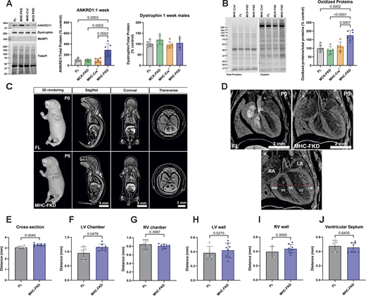 Effects of FKBP12 deficiency on 1-wk-old mice. (A) Protein expression of several RNA-seq detected transcripts was validated using western blot of hearts from (A) 1-wk-old mice. Proteins of interest were normalized to the total protein level in the same lane, normalized to the average expression level in FL hearts, and expressed as %FL. Data were analyzed by one-way ANOVAs with P value indicated. n = 6 for all genotypes. Data are shown as mean ± SD. (B) Oxyblot and analysis of oxidized proteins in hearts of 7-day-old mice of each genotype. (C) Iodine contrast microCT for cardiac phenotyping of P0 FL and MHC-FKD mice. Micro CT 3D imaging was performed on iodine contrasted FL (n = 5) and MHC-FKD (n = 8) neonates at birth (postnatal day 0, P0) to examine the gross morphology and phenotyping. 3D whole volume rendering and digitally sectioned at sagittal, coronal, and transverse axes and were a mixture of males and females (seven females, eight males). Sex differences were not detected. (D) Digital image showing cardiac structure of the right atrium (RA), left atrium (LA), right ventricular wall (RW), right ventricle (RV), ventricular septum (VS), left ventricle (LV), and left ventricular wall (LW) were examined. The thickness of the left/right ventricular walls and septum and the width of the left/right ventricles were measured along the dashed red line for each sample. (E and F) Quantitative analysis shows significant increases the (E) cross section of ventricles (P = 0.0045) and (F) LV Chamber width (P = 0.0478) in MHC-FKD neonates. (G and H) RV chamber (G), LV wall (H). (I and J) (I) RV wall and (J) ventricular septum (all datapoints provided) were not significantly different. Data were analyzed by one-way ANOVAs with P value indicated. Data are shown are mean ± SD. Source data are available for this figure: SourceData F9. Refer to the image caption for details.