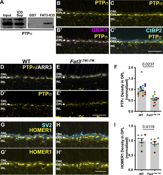 PTPσ and HOMER1 localization in WT and FAT3 mutant retinas. (A) Western blot for PTPσ in protein lysate (input), in the supernatant after pulldown with a GST fusion to FAT-ICD (sup), and in the pellet after pulldown with GST alone (GST) or a FAT3-ICD GST fusion protein. (B and B′) Immunostaining of PTPσ (yellow) and GRIK1 (magenta, B′) in the OPL region of WT retinal sections. (C and C″) Immunostaining of PTPσ (yellow) and CtBP2 (cyan, C″), a marker of presynaptic terminals in photoreceptor axons. (D and D′) Immunostaining of PTPσ (yellow) and ARR3 (white) and PTPσ (D′) alone in the OPL region of WT retinal sections. (E and E′) Immunostaining of PTPσ (yellow) and ARR3 (white) and PTPσ (E′) alone in the OPL region of Fat3∆TM/∆TM retinal sections. (F) Quantification of PTPσ integrated intensity (normalized) in the OPL. WT Controls: 1.00 ± 0.07 (n = 4 animals, 16 retinal regions); Fat3∆TM/∆TM: 0.56 ± 0.05 (n = 3 animals, 12 retinal regions). Each data point corresponds to a retinal region, color-coded by animal, nested two-tailed test. Error bar: SEM. (G and G′) Immunostaining of HOMER1 (yellow) and SV2 (cyan), and HOMER1 (G′) alone in WT retinal sections. (H and H′) Immunostaining of HOMER1 (yellow) and SV2 (cyan), and HOMER1 (H′) alone in Fat3∆TM/∆TM retinal sections. (I) Quantification of HOMER1 integrated intensity in the OPL. WT Controls: 1.00 ± 0.07 (n = 3 animals, eight retinal regions); Fat3∆TM/∆TM: 0.91 ± 0.06 (n = 3 animals, eight retinal regions). Each data point corresponds to a retinal region, color-coded by animal, nested two-tailed test. Error bar: SEM. Scale bars: 20 µm. Source data are available for this figure: SourceData F6.