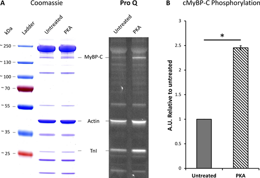 Quantification of cMyBP-C phosphorylation after PKA treatment of porcine cardiac myofibrils. Protein was isolated from PKA-treated myofibrils and compared with untreated myofibrils. (A) Samples were run on a 4–20% gradient SDS-PAGE gel and stained with Pro-Q Diamond Phosphoprotein Gel Stain (right) followed by Coomassie blue stain (left) to quantify total protein. (B) Densitometry analysis was performed on the cMyBP-C Pro-Q bands normalized to the same band in the Coomassie gel, and cMyBP-C treatment with PKA results in a ∼2.5-fold increase in phosphorylation relative to the untreated group (N = 1, n = 2). Data shown are the mean ± SEM. Significance was calculated with a one-tailed t test, *P = 0.025. Source data are available for this figure: SourceData F3.
