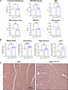 The multi-panel image presents a comparative analysis of cardiac function and structure between W T and Ttn Delta A164-167.