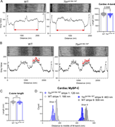 Electron micrographs and graphs show thick filament length and cMyBP-C mapping in W T and TtnA164-167 sarcomeres.