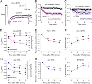 Multiple time course graphs depict effects of cholesterol enrichment on H C N channel function in D R G neurons from naive and S N I animals.