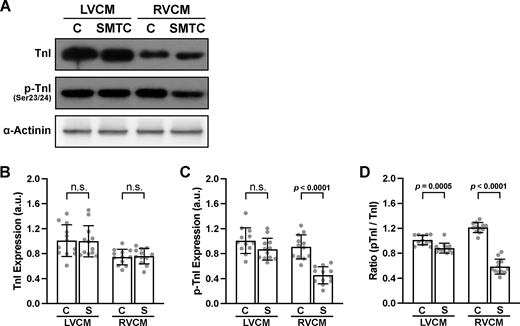 A multi-panel image presents immunoblot analysis and quantification of troponin I (TnI) and its phosphorylated form in left and right ventricular cardiomyocytes.