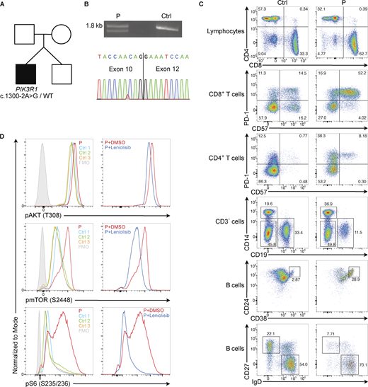 PIK3R1 c.1300-2A>G variant causes activated PI3Kδ syndrome 2. (A) Family pedigree with the patient shaded black and the unaffected family members white. (B) Amplification and sequencing of PIK3R1 cDNA between exons 2 and 15; mRNA was extracted from T cell blasts of patient (P) and healthy control subject (Ctrl) 3. PCR products were visualized on an agarose gel (top). Sequencing of the PCR product with Oxford Nanopore Technology showed loss of exon 11 in one of two consensus sequences from P (bottom); the WT sequence is not shown. (C) Representative flow cytometric analysis of PBMC from Ctrl 3 and P (prior to leniolisib therapy). (D) Flow cytometric analysis of the phosphorylation of AKT at threonine residue 308, mTOR at serine residue 2448, and S6 at serine residues 235/236 in expanded T cell blasts from P and Ctrl 1–Ctrl 3 after treatment with DMSO for 30 min (left), and the same analysis of T cell blasts from P after a 30-min incubation with 500 nM leniolisib vs. DMSO (right). Left and right columns in panel D represent the same experiment. DMSO, dimethyl sulfoxide. Source data are available for this figure: SourceData F1.