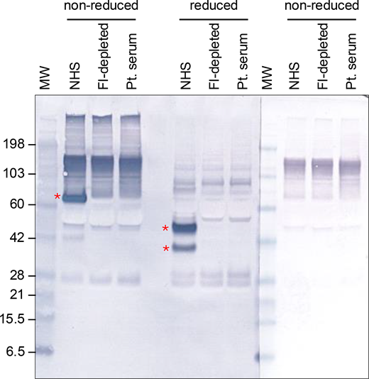 Reactivity of FI-deficient patient’s serum with goat anti-human FI. Proteins in NHS, FI-depleted serum, and the Pt. serum, all at a final dilution of 1:100 in 4× LDS sample buffer (either nonreduced or reduced with 10% ß-mercaptoethanol), were separated on a 4–12% Bis-Tris gel and probed with goat polyclonal anti-FI antibody followed by ALP-conjugated anti-goat IgG. Asterisks highlight detection of FI (combined heavy and light chains in nonreduced samples, heavy and light chains in reduced samples) in NHS and absence in FI-depleted serum and the patient’s serum. A third parallel section of the membrane (nonreduced samples) was probed with the secondary antibody (ALP-conjugated anti-goat IgG) only. All sections of the blot were exposed to substrate for the same length of time. MW, molecular weight marker (kDa); Pt. serum, patient’s serum. Source data are available for this figure: SourceData F3.