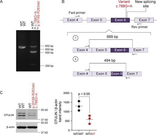 Aberrant OTULIN splicing in patient F.II.3. (A) Reverse transcription PCR amplification of OTULIN mRNA spanning the variant site carried in heterozygosity in patient F.II.3. (B) Schematic representation of the altered mRNA transcript induced by the novel splice acceptor in patient F.II.3. (C) OTULIN expression relative to β-actin in whole-cell lysates of T cells from patient F.II.3 in comparison with those from a healthy control. Shown blot is a representative image, with the plot displaying the relative band intensity of OTULIN over β-actin with N = 3 biological replicates. Bars represent mean ± SD. Statistical significance was calculated by an unpaired T test. WT/WT, healthy donors; WT/MT, OTULIN haploinsufficient patient; MT, mutant; WT, wild-type. Source data are available for this figure: SourceData F4. Refer to the image caption for details.