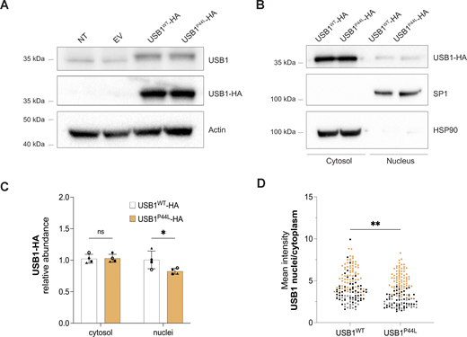 USB1P44Lhas an altered subcellular localization. (A–C) Western blot analysis of total cell (A) and cytosol vs. nucleus lysates (B and C) obtained from HEK293T cells ectopically expressing USB1-HA variants. Bars and error bars are averages of USB1-HA relative abundance normalized to HSP90 (cytosol) and SP1 (nucleus), and SD from four independent experiments. Two-way ANOVA statistical analysis was performed. “ns,” nonsignificant differences (P ≥ 0.05), *P < 0.05 (n = 4). (D) Semiautomatic quantification of immunofluorescence staining confirmed a decreased mean intensity nuclear vs. cytosolic ratio for HEK293T cells expressing USB1P44L protein. Each independent experiment (n = 3) was represented with a different color. A minimum of 25 cells were analyzed for each independent experiment. An unpaired t test was performed. **P < 0.01. Source data are available for this figure: SourceData F2.