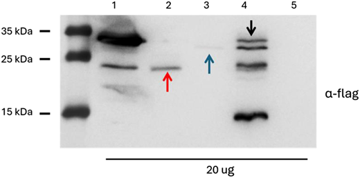 Western blot analysis performed on HEK293 cell lysates transfected with dual-intein pLenti EGFP plasmids with the additional ATM nucleotides surrounding the splitting point. Cell lysates from cells transfected with: 1. pLenti EGFP full-length; 2. dual-intein pLenti N-term; 3. dual-intein pLenti C-term EGFP; 4. dual-intein pLenti N-term + dual-intein pLenti C-term with additional nucleotides from ATM CDS; 5. untransfected cells. Black arrow indicates EGFP full length with additional amino acids from ATM CDS; red and blue arrows indicate the N- and the C-term products, respectively. Refer to the image caption for details.