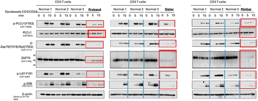 T cells from the proband, his affected sister, and his affected mother showed decreased total ZAP70 protein as well as decreased ZAP70 signaling (phospho-ZAP70, phospho-LAT, and phospho-ERK).
