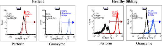 Perforin and granzyme flow cytometry of patient and healthy sibling.