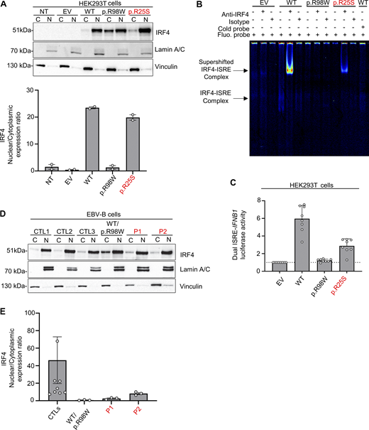 p.R25S underlies IRF4 deficiency. (A) Upper panel: Western blot for IRF4, lamin A/C, and vinculin on cytoplasmic (C) and nuclear (N) extracts from HEK293T cells not transfected (NT) or transfected with EV or various IRF4 cDNAs. Lower panel: Quantification of the IRF4 nuclear/cytoplasmic expression ratio based on band intensity analysis from western blots. Data representative of two independent experiments are shown. (B) EMSA and supershift assays with the nuclear extract of HEK293T cells transfected with EV or various IRF4 cDNAs and incubated with a fluorescent ISRE probe. The IRF4–ISRE complex and the supershifted IRF4–ISRE complex are indicated with arrows. Representative data from two independent experiments are shown. (C) Dual luciferase ISRE-IFNB1 reporter activity of HEK293T cells transfected with EV or with various IRF4 cDNAs. Data from eight independent experiments performed in triplicate are shown. Dotted-line represent the normalization to EV. (D) Upper panel: Western blot for IRF4, lamin A/C, and vinculin on cytoplasmic (C) and nuclear (N) extracts of EBV-B cells from three healthy controls (CTLs), patients, and an individual heterozygous for the p.R98W IRF4 variant. Lower panel: Quantification of the IRF4 nuclear/cytoplasmic expression ratio based on band intensity analysis from western blots. Representative data from three independent experiments are shown. Source data are available for this figure: SourceData F2. Refer to the image caption for details.
