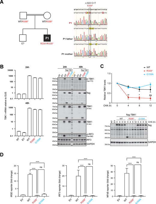 Homozygosity for a LOF TBK1 mutation in the patient. (A) Family pedigree showing segregation of the TBK1 mutation. PCR products were amplified from genomic DNA extracted from the granulocytes of P1 and both parents and subjected to Sanger sequencing. (B)TBK1 mRNA levels (upper panel) were determined by RT-qPCR on HEK293T cells 24 and 48 h after transfection with empty vector (EV), WT, and mutant TBK1 constructs. Western blot analysis was performed to assess the levels of protein for TBK1 (lower panel), autophosphorylated TBK1 (p-TBK1, Ser172), IRF3, and autophosphorylated IRF3 (p-IRF3, Ser396) in HEK293T cells at 24 and 48 h after transfection with EV, N-terminally flag-tagged WT, and mutant TBK1 constructs. The results shown are representative of three independent experiments. (C) Pulse-chase analysis of WT and mutant TBK1 protein stability. HEK293T cells were transfected with flag-tagged WT or mutant TBK1 expression plasmids for 24 h. Cells were then treated with cycloheximide (CHX; 100 ng/ml) for the indicated time points to inhibit protein synthesis, followed by western blot analysis (bottom). TBK1 protein levels were quantified by densitometry, normalized to GAPDH, and plotted over time (top). Data shown are representative of three independent experiments. The data shown are the means ± SEM of three independent experiments. P values were obtained by one-way ANOVA with Tukey’s multiple comparisons tests, and the P values for the 4-, 8-, and 12-h time points are indicated for the comparison of P1’s cells with control cells. ns; P > 0.05; *P < 0.05; and **P < 0.01. (D) ISRE, IRF3, and NF-κB promoter-driven luciferase reporter assays were performed on HEK293T cells 24 h after transfection with ISRE, IRF3, or NF-κB reporter plasmids along with EV, WT, and mutant TBK1 constructs. Luciferase activity was measured to assess TBK1-mediated activation. The results shown are representative of three independent experiments. The data shown are the means ± SEM of three experiments with three biological replicates, P values were obtained by one-way ANOVA with Tukey’s multiple comparisons tests. ns; P > 0.05, ****P < 0.0001. Source data are available for this figure: SourceData F2. Refer to the image caption for details.