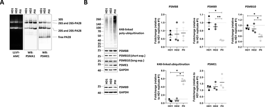 PSMB10 p.Ser208Phe variant is associated with decreased immunoproteasome expression, reduced PA28–proteasome complexes, diminished proteasome activity, and disrupted protein homeostasis in PIII-derived T cells. (A) T cells expanded from PBMCs of patient PIII and two age-matched healthy male and female donors (HD) were subjected to protein extraction, followed by native-PAGE separation and in-gel overlay assays (LLVY-AMC) to assess proteasome activity, as well as western blotting using PSMA1- and PSME1-specific antibodies. Lines indicate the migration positions of the 30S, 26S, and 26S–PA28 (hybrid) complexes, as well as the 20S and 20S–PA28 complexes, and the free PA28 heptameric ring. (B) Protein lysates from A were analyzed by SDS-PAGE and western blotting using antibodies directed to K48-linked ubiquitinated proteins PSMB8, PSMB9, PSMB10, PSME1, and GAPDH, with GAPDH serving as a loading control. Shown is one representative experiment (left) and densitometric analyses (right), with data expressed as fold-change mean values (n = 3) relative to a replicate of HD1, which was set to 1 after normalization to GAPDH. Statistical significance was assessed using a paired t test (*P < 0.05 and **P < 0.01). Source data are available for this figure: SourceData F3.