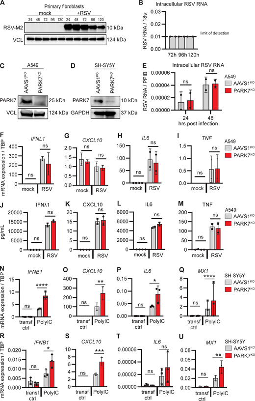 Generation of PARK7-deficient A549 and SH-SY5Y cells and cytokine responses to RSV infection. (A and B) Immunoblot and RT-PCR demonstrating absence of RSV replication in primary fibroblasts. Primary fibroblasts from a healthy donor were infected with RSV (RSV-A strain Long, MOI 1), and cells were collected at indicated time points. Whole cell lysates were analyzed by immunoblotting for expression of RSV matrix protein (RSV-M2) and compared to vinculin (VCL) as loading control (A), and cells were collected for RNA extraction and quantification of RSV RNA by RT-PCR (B). (C and D) Immunoblot demonstrating KO of PARK7 in A549 pulmonary cells (C) and PARK7 KO in neuronal SH-SY5Y cells (D). Vinculin (VCL, C) and GAPDH (D) were used as loading control. (E) Repeat of experiment shown in Fig. 4 A, showing additional replicates of two experiments performed in duplicate of human pulmonary A594 cells deficient in PARK7 (red) and control AAVS1KO (grey) mock treated or infected with RSV (RSV-A strain Long, MOI 1) for 24 and 48 h, and cells were collected for RNA isolation and analysis of RSV RNA by RT-PCR. (F–M) PARK7KO (red) and control AAVS1KO (grey) A549 cells were mock treated or infected with RSV (RSV-A, strain Long, MOI 1) for 24 h. (F–I) Cells were collected for RNA isolation, and quantification of IFNL1 (F), CXCL10 (G), IL6 (H), and TNF (I) gene transcription was performed by RT-PCR. (J–M) Cell culture supernatants were collected for IFNλ1 (J), CXLC10 (K), IL6 (L), and TNF (M) protein quantification by ELISA. (N–U) Repeats of experiment shown in Fig. 4, D–G, showing an additional two repeat experiments performed in triplicate (N–Q shows the second experiment and R–U shows the third experiment) where neuronal SH-SY5Y cells deficient in PARK7 or control AAVS1KO were mock transfected (transf ctrl) or transfected with PolyIC (500 ng/ml). Cells were collected after 6 h, and RNA was isolated, and IFNB1 (N and R), CXCL10 (O and S), IL6 (P and T), and MX1 (Q and U) gene transcription quantification by RT-qPCR. Bars indicate mean ± SD values. Statistics were calculated using the two-way ANOVA with multiple comparisons. * = P < 0.05, ** = P < 0.01, *** = P < 0.001, and ns = not significant. SD, standard deviation. Source data are available for this figure: SourceData SF3.