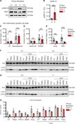 Impaired RSV-induced apoptotic cell death and reduced autophagy in patient primary fibroblasts. (A and B) Whole cell lysates from dermal fibroblasts from three controls (C, grey) and the patient (P, red) were analyzed for phosphorylation of ASK1/2 (pASK1/2), total ASK1, and vinculin (VCL) as loading control by immunoblotting (A). Graph depicting the densitometric quantification of pASK1/2 relative to total ASK1 (B). Bars show mean ± SD values of four experiments. (C–E) Primary fibroblasts from two controls (C, grey) and the patient (P, red) were stained with Annexin-V (apoptosis) and SYTOX Green (viability dye) to analyze induction of noninflammatory apoptotic cell death by flow cytometry. Cells were left untreated (UT) or treated with staurosporine (1 mM, 4 h) (C), mock transfected (transf ctrl) or transfected with PolyIC (tPolyIC, 500 ng/ml, 24 h) (D), or infected with mock virus (mock) or RSV (RSV-A strain Long, MOI 3, 24 h) (E). Bars show mean ± SD values of two experiments performed in duplicate and triplicate. (F–H) Primary fibroblast from three controls (C1–3) and the patient (P) were left untreated (UT), stimulated with rapamycin (Rapa, 500 nM, 24 h), HSV-2 (MS strain, MOI 1, 24 h), starved by culture in EBSS (4 h) or stimulated with H2O2 (300 nM, 30 min), in the absence or presence of chloroquine (+CQ, 20 μM, 4 h) to evaluate autophagy flux. Whole cell lysates were analyzed by immunoblot for LC3 lipidation and conversion of LC3-I into the smaller LC3-II with VCL as loading control. (H) Graph showing the ratio LC3-II/LC3-I as indicator for autophagy induction in primary fibroblasts from three controls (C, grey bars) and the patient (P, red). The ratio of LCR3-II/LC3-I was quantified using densitometry analysis of immunoblots in F and G. Bars show mean ± SD values. Statistics were calculated using the unpaired T test (B) and ordinary two-way ANOVA with Šídák’s multiple comparisons (C–E). ** = P < 0.01, *** = P < 0.001, and ns = not significant. SD, standard deviation. Source data are available for this figure: SourceData F3.