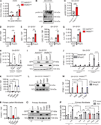 Enhanced cellular stress pathways and hyperinflammatory cytokine responses in PARK7-deficient neuronal SH-SY5Y cells. (A) Human pulmonary A594 cells deficient in PARK7 (red) and control AAVS1KO (grey) were mock treated or infected with RSV (RSV-A strain Long, MOI 1) for 24 and 48 h, and cells were collected for RNA isolation and analysis of RSV RNA by RT-PCR. Bars indicate mean ± SD values of two experiments, performed in duplicate. Repeats of the experiments are shown in Fig. S3 E. (B and C) Whole cell lysates from SH-SY5Y with PARK7KO (red) or AAVS1KO (control, grey) were analyzed for phosphorylation of ASK1/2 (pASK1/2) and expression of total ASK1 and vinculin (VCL) as loading control by immunoblotting (B). Graph depicting the densitometric quantification of pASK1/2 relative to total ASK1 (C). Bars indicate the mean ± SD values of three experiments. (D–G) Neuronal SH-SY5Y cells deficient in PARK7 or control AAVS1KO were mock transfected (transf ctrl) or transfected with PolyIC (tPolyIC, 500 ng/ml). Cells were collected after 6 h, and RNA was isolated, and IFNB1 (D), MX1 (E), CXCL10 (F), and IL6 (G) gene transcription quantification by RT-PCR. Bars indicate mean ± SD values of a representative experiment performed in triplicate. Repeats of the experiment are shown in Fig. S3, N–Q and R–U. (H–J) Neuronal SH-SY5Y cells deficient in PARK7 or AAVSKO (control) were left untransduced (−) or were transduced with lentiviral vectors to express PARK7 or GFP (control). Cells were collected after 48 h for RNA isolation to determine PARK7 mRNA expression (H), and whole cell lysates were analyzed by immunoblotting for GFP and PARK7 expression with VCL as loading control (I). (J) Cells were transfected with PolyIC (tPolyIC, 500 ng/ml) and collected after 6 h for quantification of IFNB1 transcription by RT-PCR. Bars indicate mean ± SD values of a representative experiment performed in duplicate. (K–M) Neuronal SH-SY5Y cells deficient for PARK7 were transduced with lentiviral vectors to express PARK7 WT, the patient PARK7 variant R28*, the R98Q variant frequent in the healthy population (MAF>10−3), and the L166P variant associated with Parkinson’s disease. Cells were collected for RNA isolation to determine PARK7 mRNA expression (K), and whole cell lysates were analyzed by immunoblotting for PARK7 expression with VCL as loading control (L). (M) Cells were transfected with PolyIC (tPolyIC, 500 ng/ml) and collected after 6 h for quantification of IFNB1 transcription by RT-PCR. Bars indicate mean ± SD values of a representative experiment performed in duplicate. (N–P) Primary fibroblasts from the patient (P) were left untransduced (−) or were transduced with lentiviral vectors to express GFP, PARK7WT, PARK7 R28*, PARK7 R98Q, or PARK7 L166P. As control (C), primary fibroblasts from a healthy donor were left untransduced or were transduced to express GFP. Cells were collected for RNA isolation to determine PARK7 mRNA expression (N), and whole cell lysates were analyzed by immunoblotting for GFP and PARK7 expression with VCL as loading control (O). Cells were infected with mock virus (mock) or RSV (RSV-A strain Long, MOI 3, 24 h) and stained with Annexin-V (apoptosis) and 7-AAD (viability dye) to analyze induction of noninflammatory apoptotic cell death by flow cytometry (P). Bars show mean ± SD values of a single experiment performed in duplicate and triplicate. Statistics were calculated using the multiple paired t test (A), the unpaired t test (C), the one-way ANOVA (H and K), and ordinary two-way ANOVA with Šídák’s multiple comparisons (J, M, and P). * = P < 0.05, ** = P < 0.01, *** = P < 0.001, and ns = not significant. SD, standard deviation. Source data are available for this figure: SourceData F4.